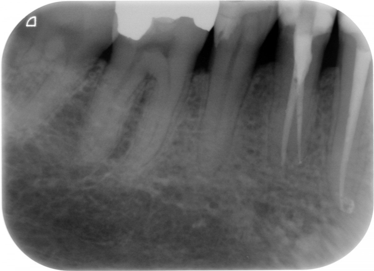 Fig. 5: A three months follow-up
