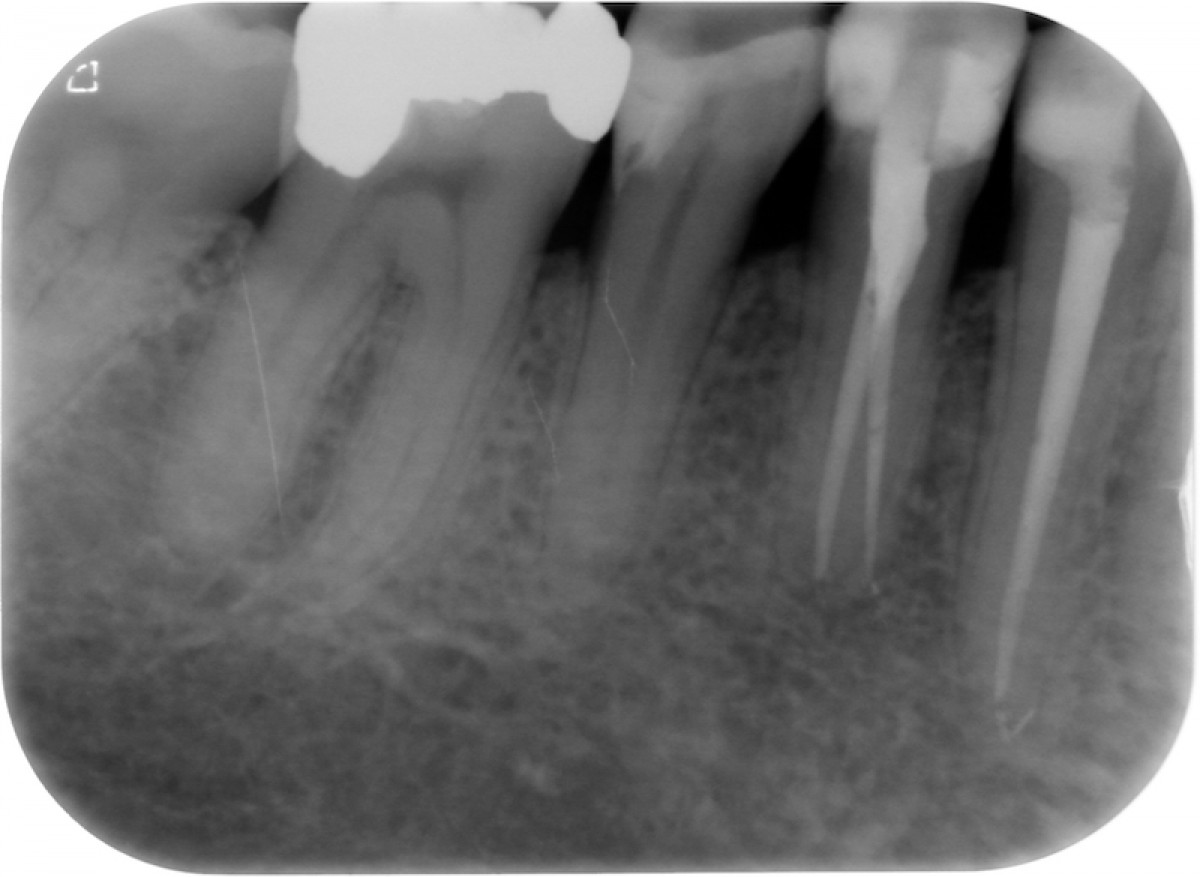 Fig. 6: One year follow-up