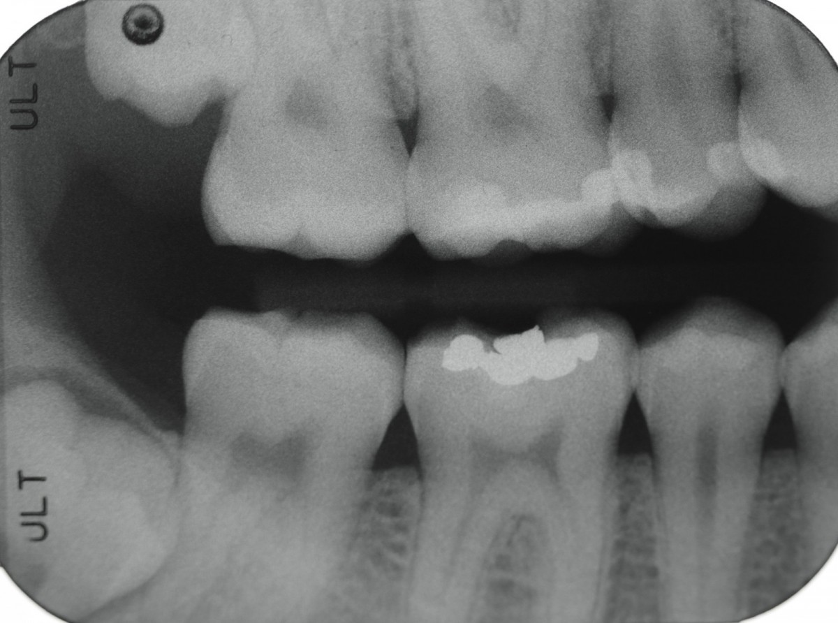 FIg 1 initial radiography.