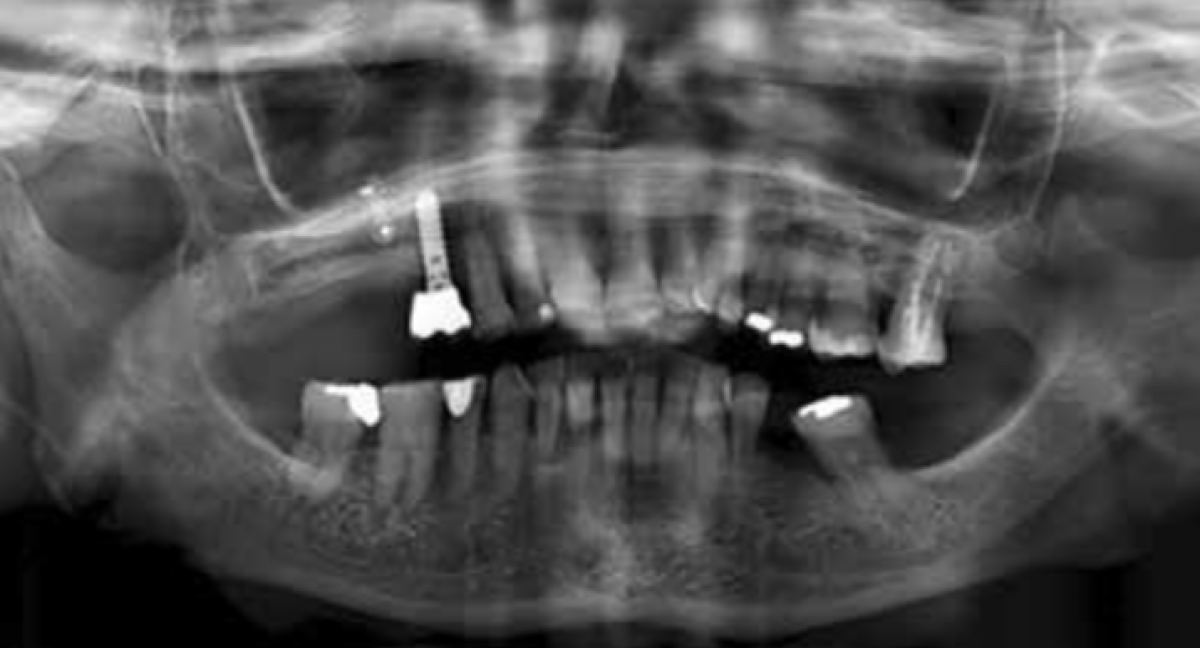 Image 1: Initial x-rays