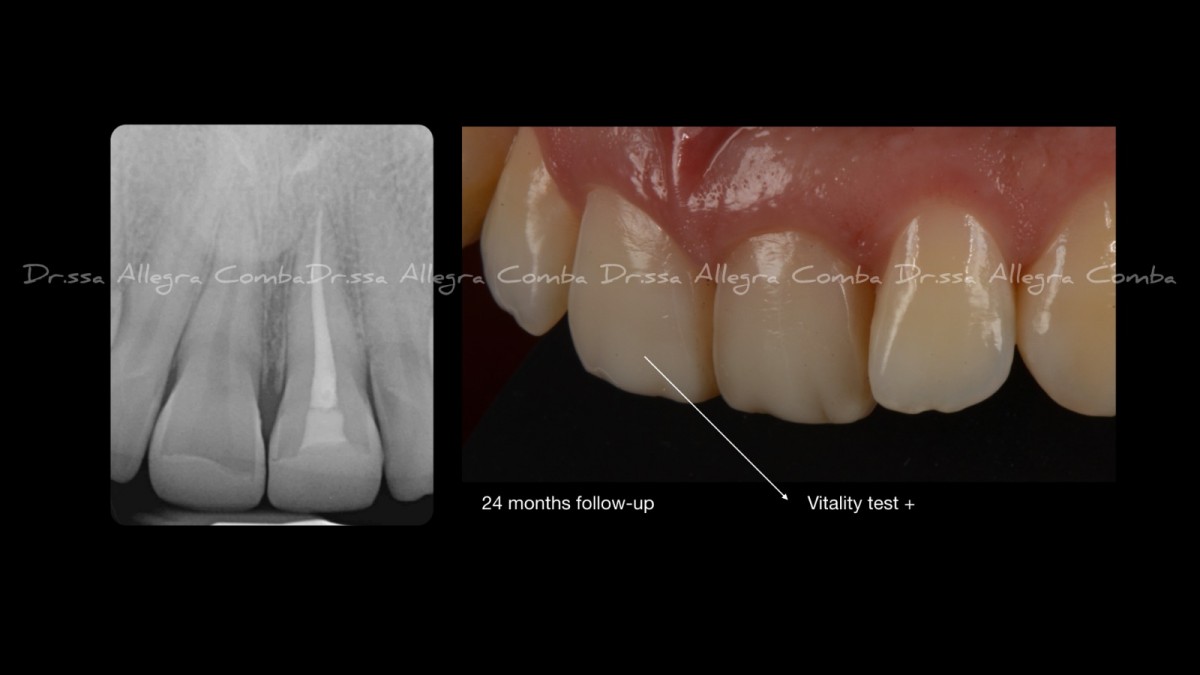 <p>figure 12</p>