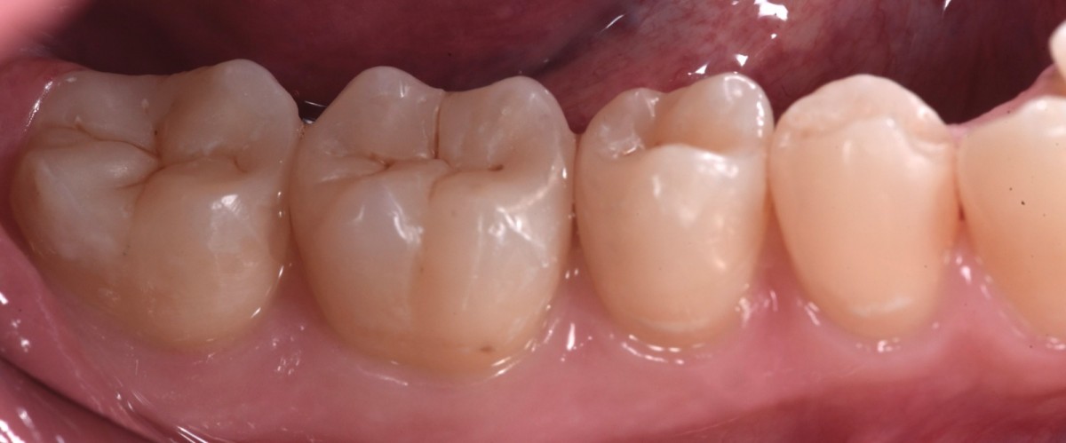 <p>figure 15</p>