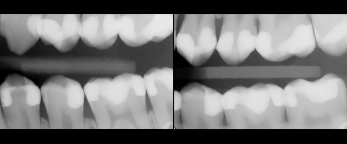 <p>figure 16</p>