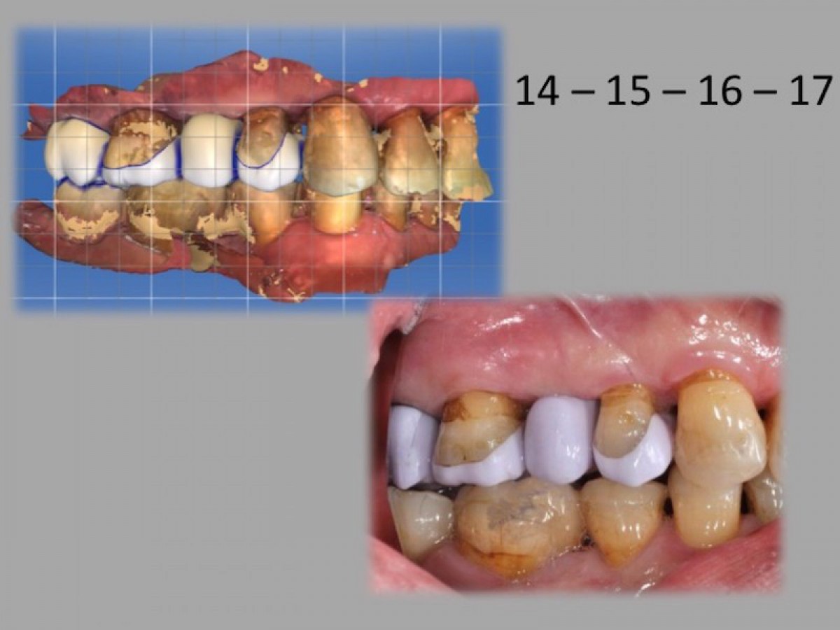 Fig.16