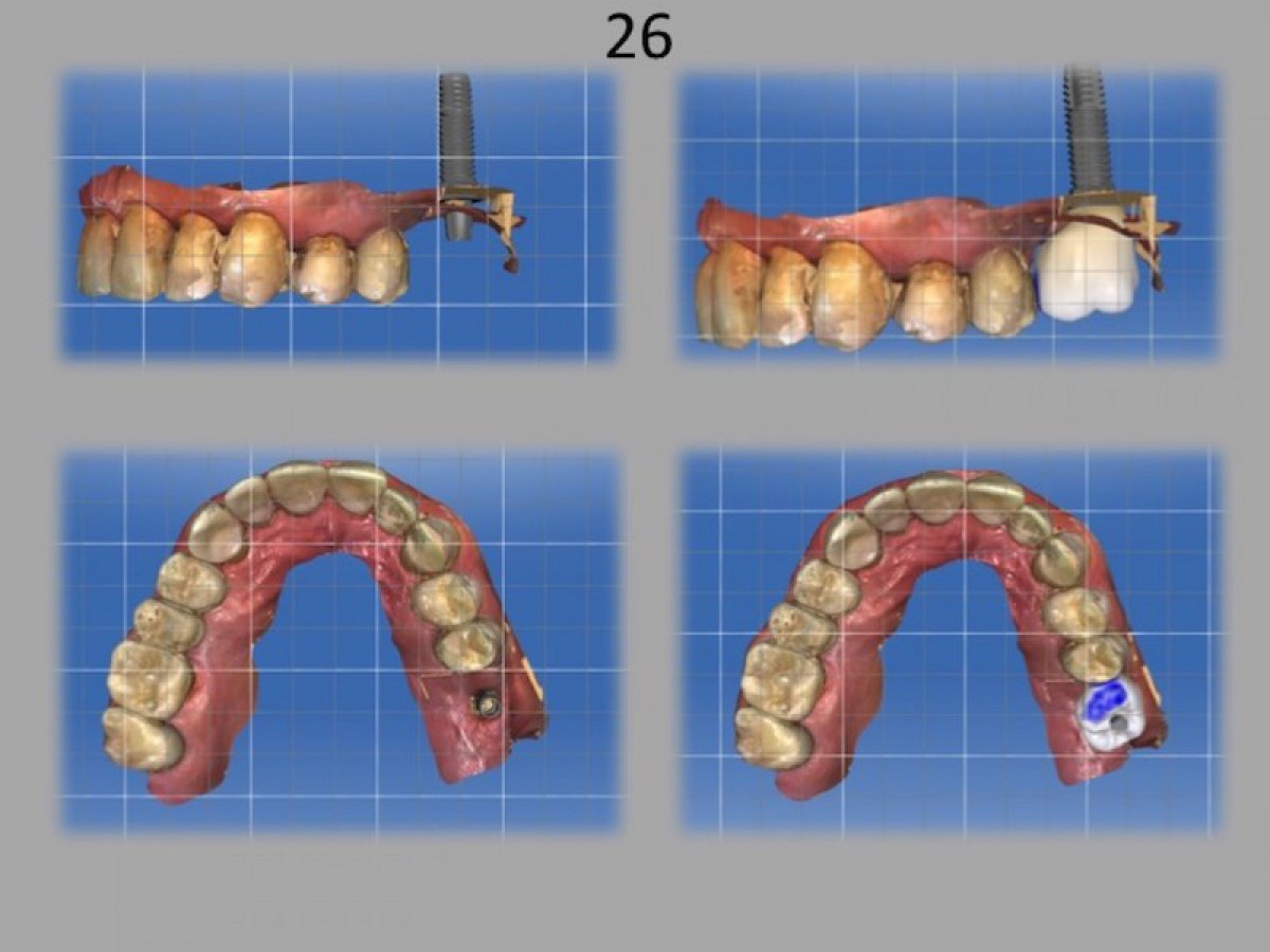 Fig.19