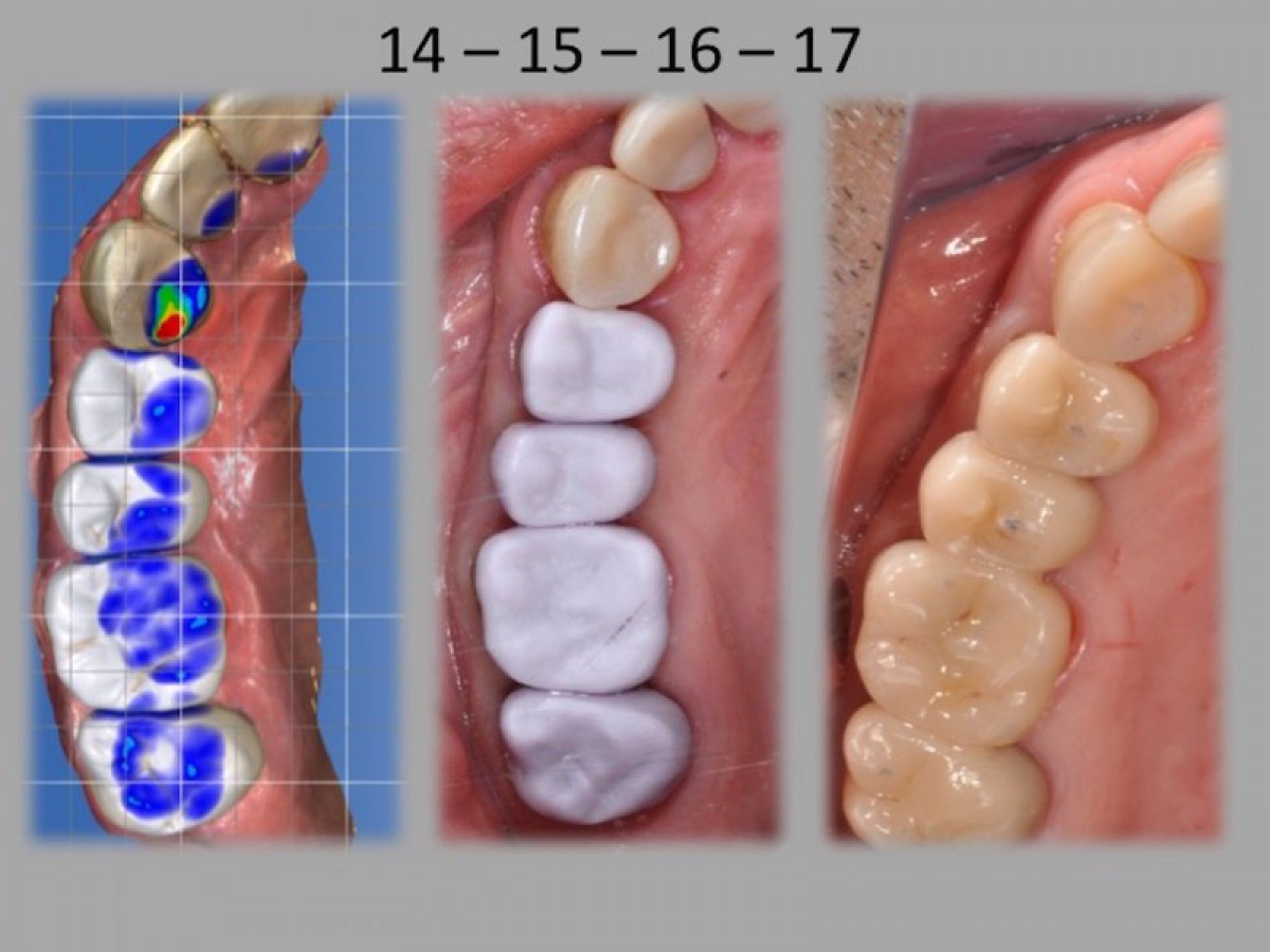 Fig.17