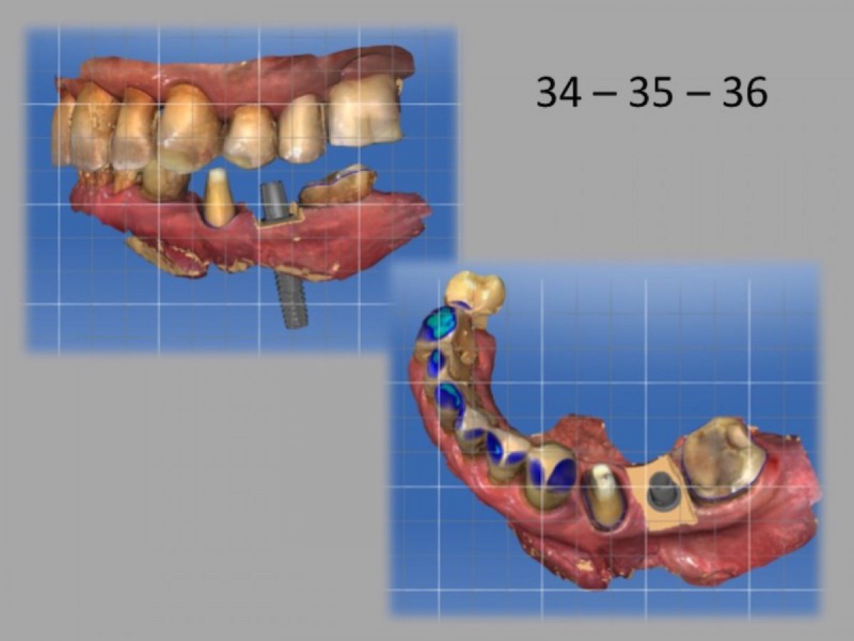 Fig.20