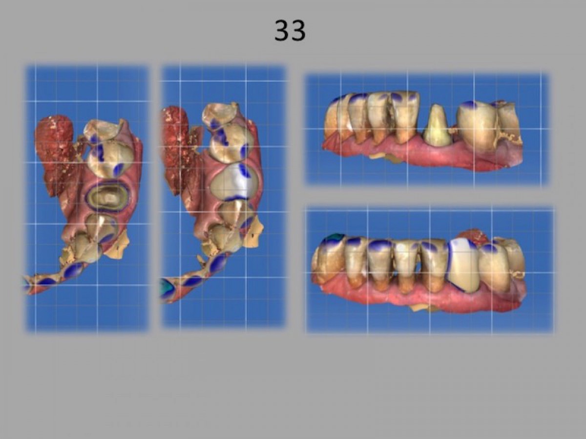 Fig.21