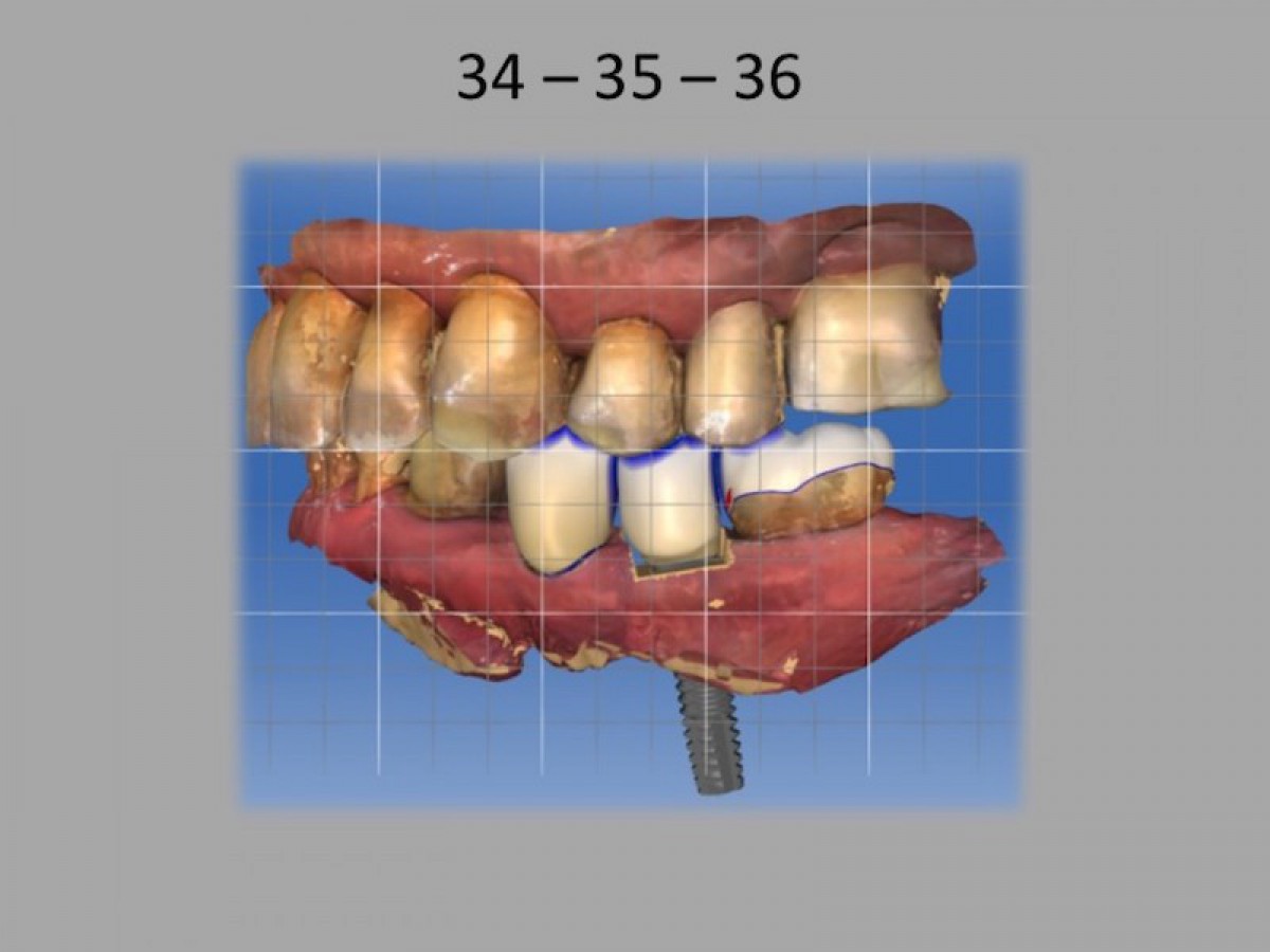 Fig.22