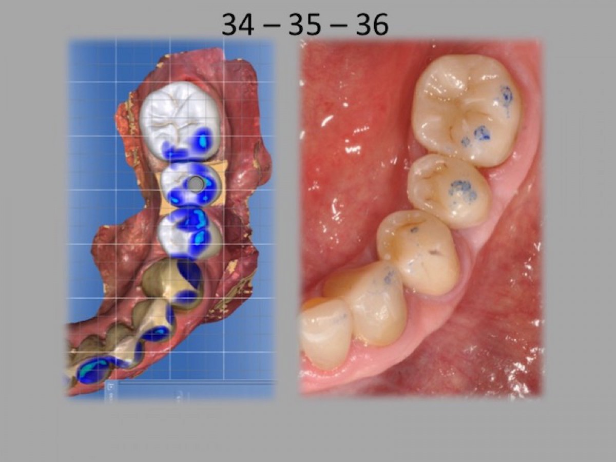 Fig.23