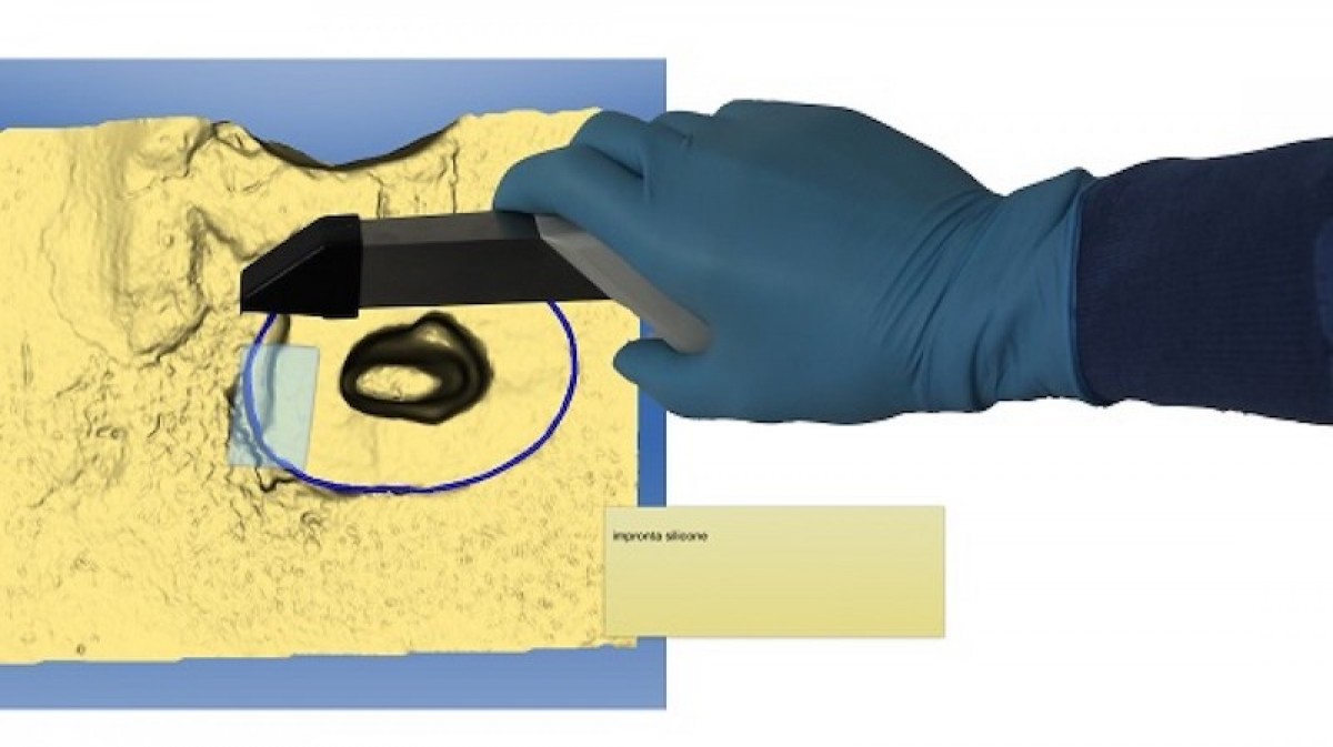 Figure 1: Taking the canal’s impression with digital method.