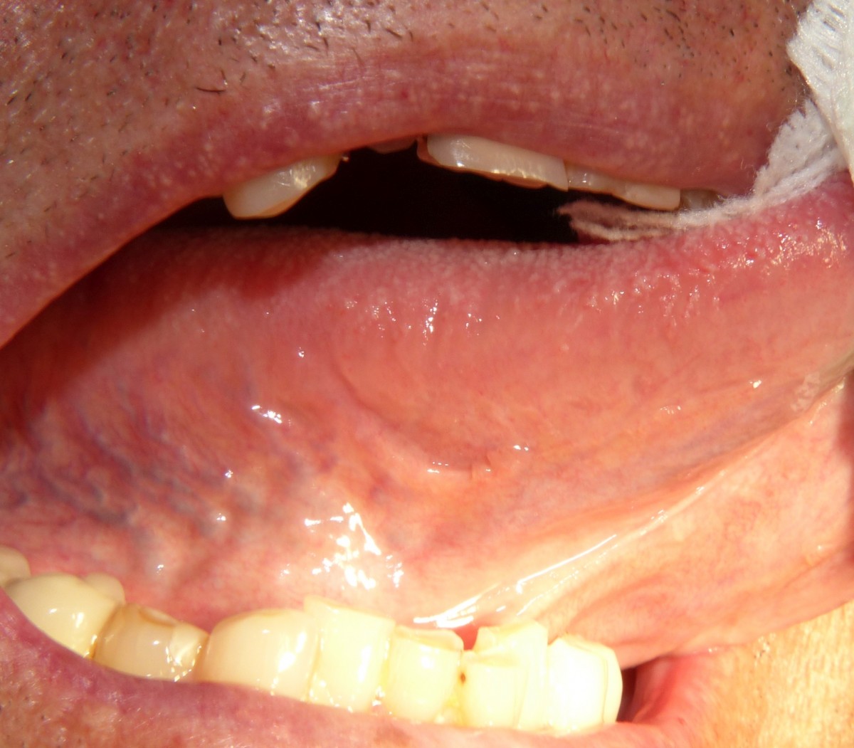 Figure 3: after 1 month control