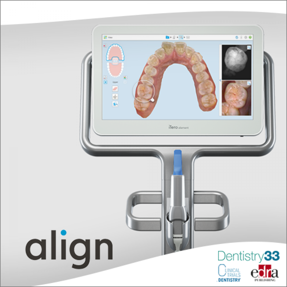 Align Technology shares findings that validates the significant
