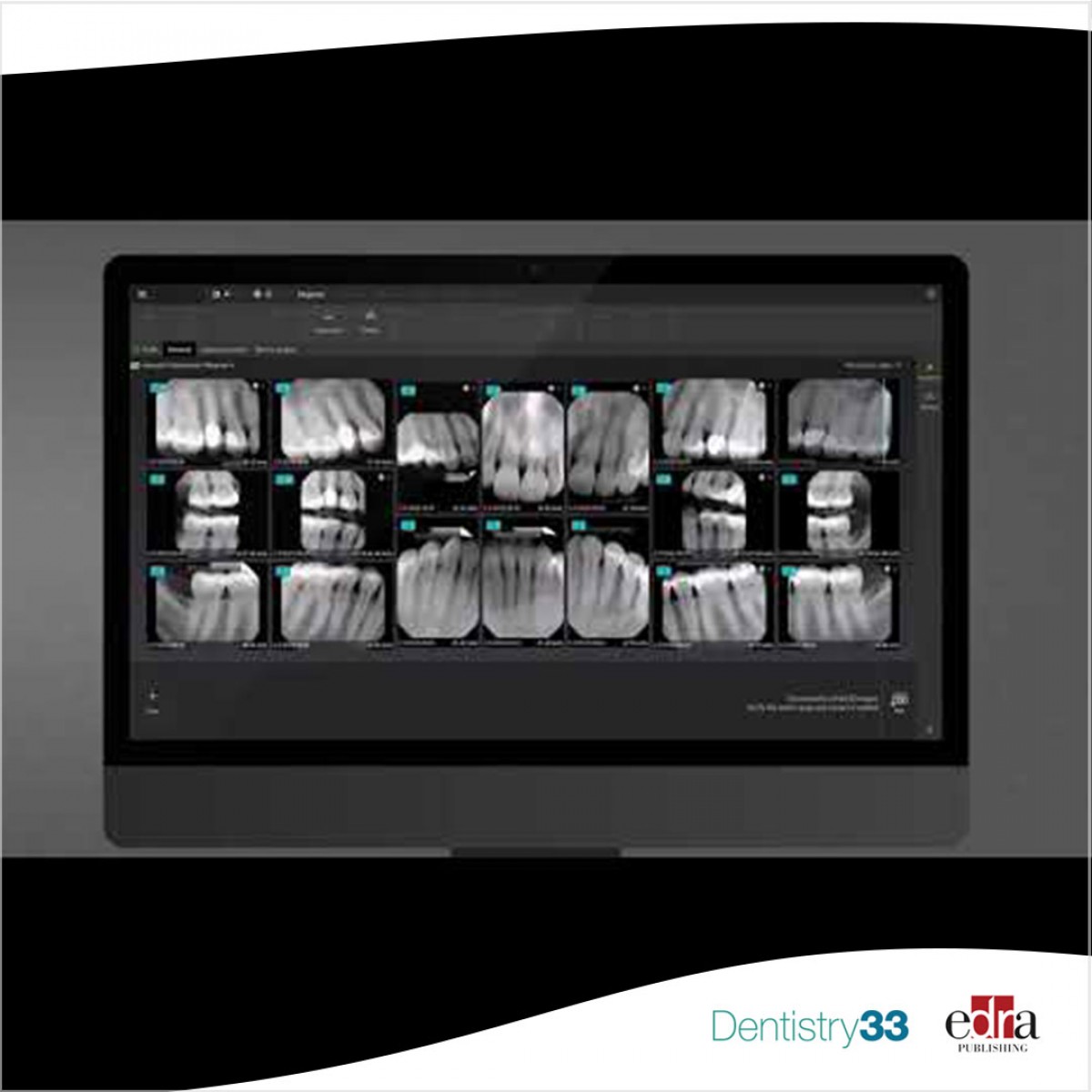 DEXIS announces FDA clearance of pathological dental findings AI on X