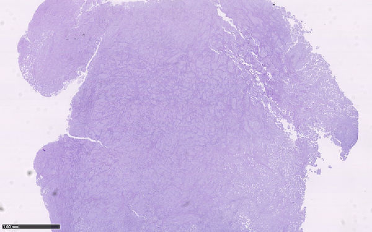 Histological image:hematoxylin and eosin at low magnification