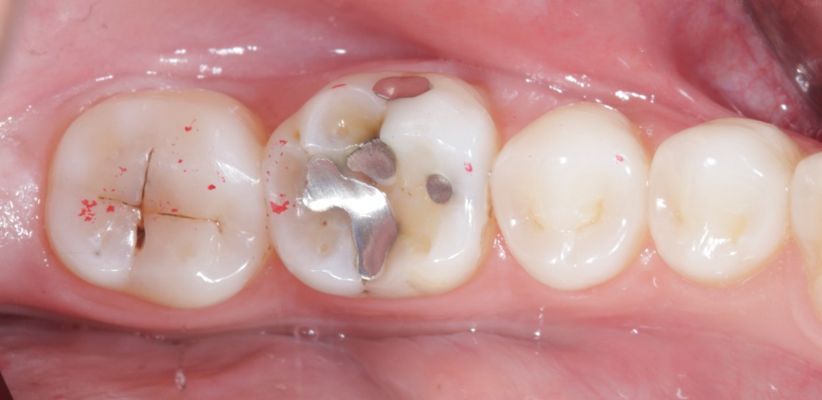 Fig 2 preoperative initial photograph.