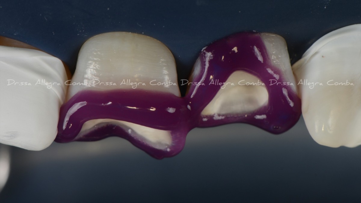 <p>figure 7</p>