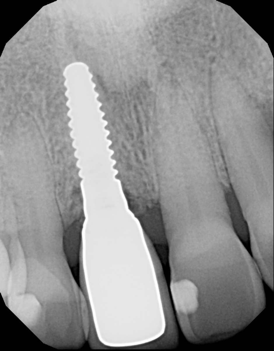 Figure 10