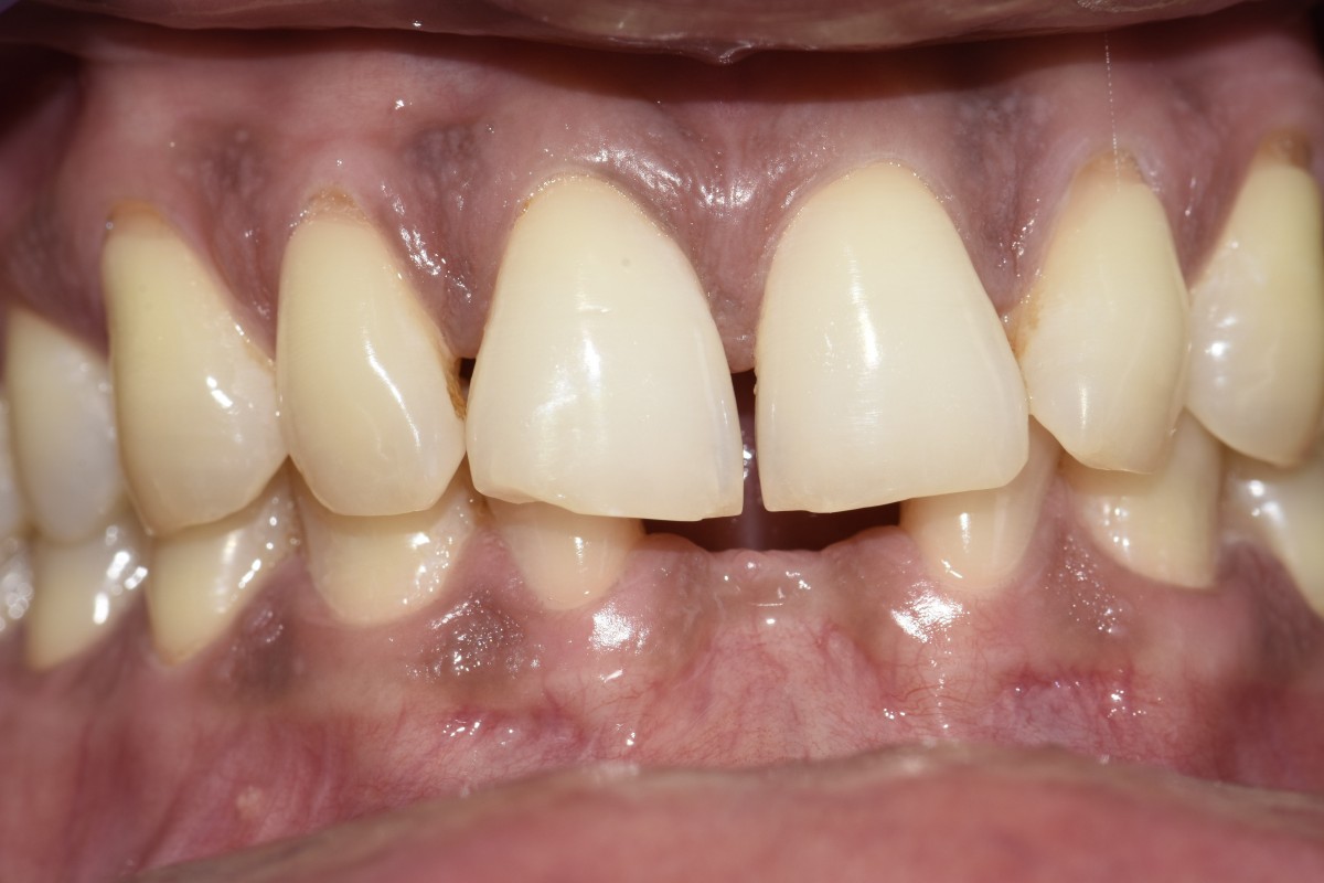 Figure 1b