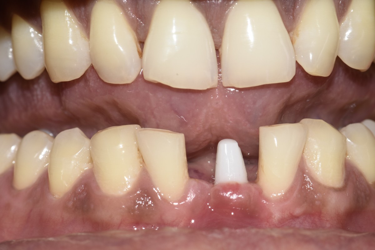 Figure 5a