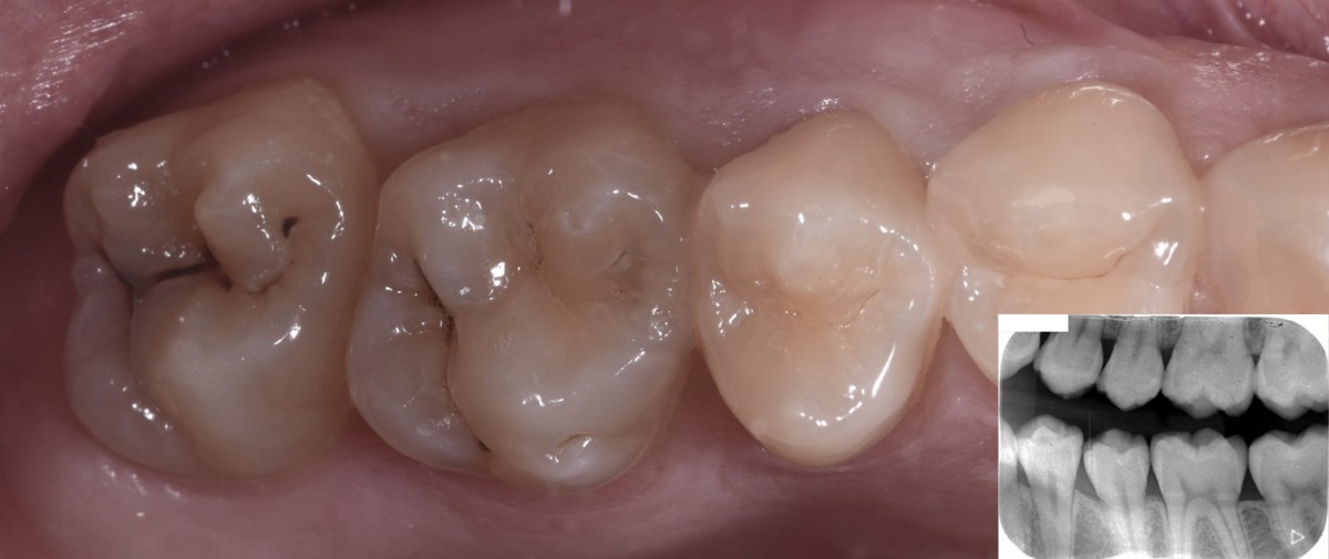 fig1