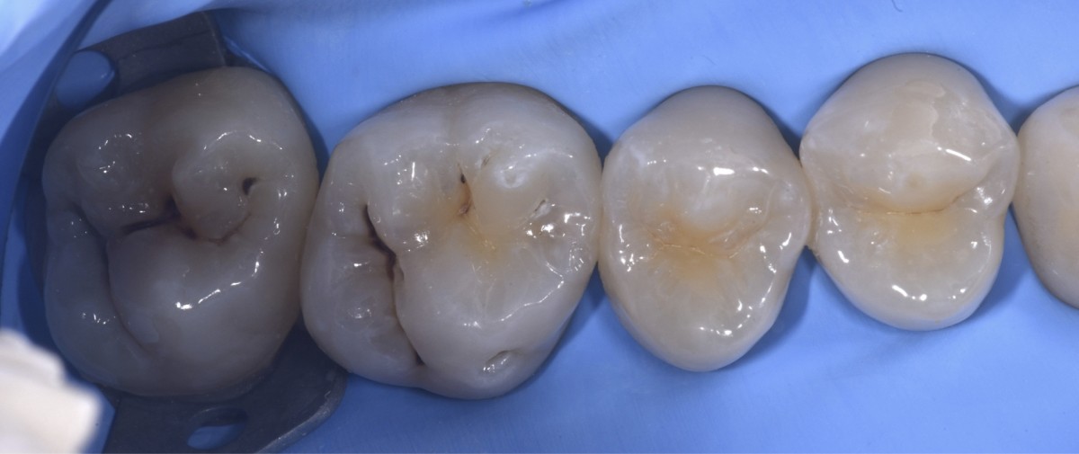 fig2