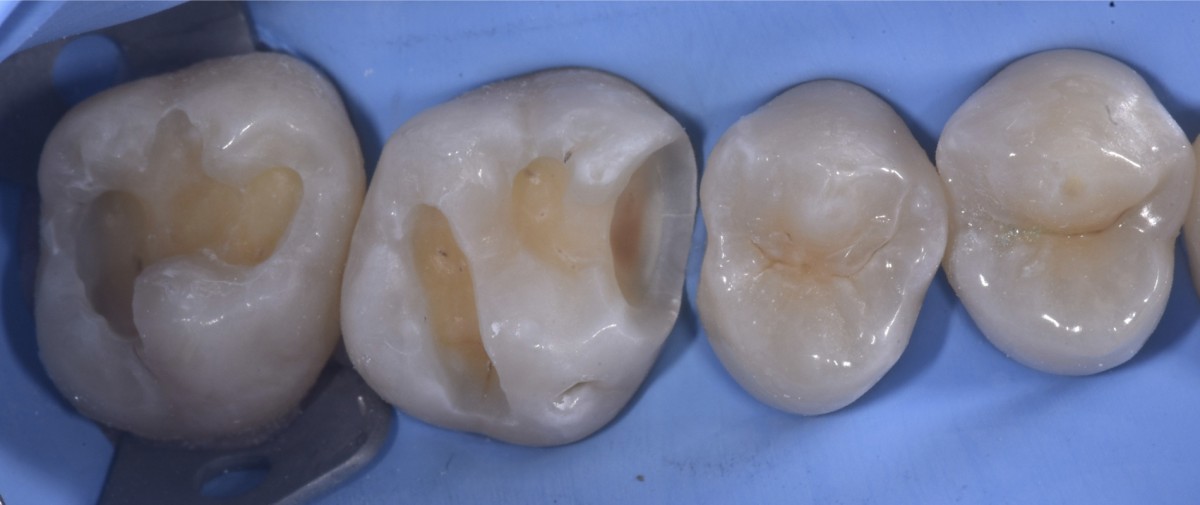 fig3