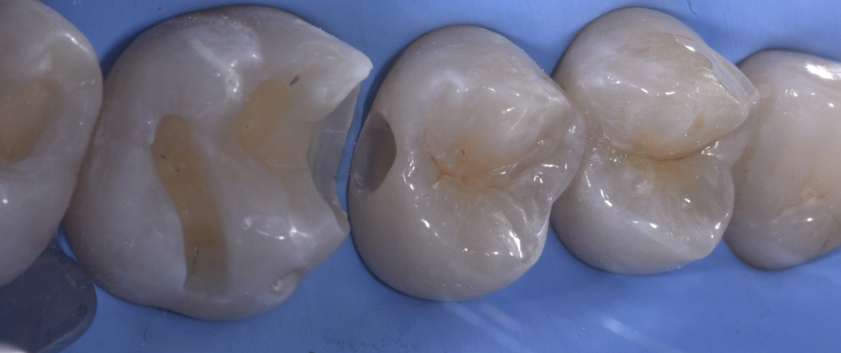 fig4