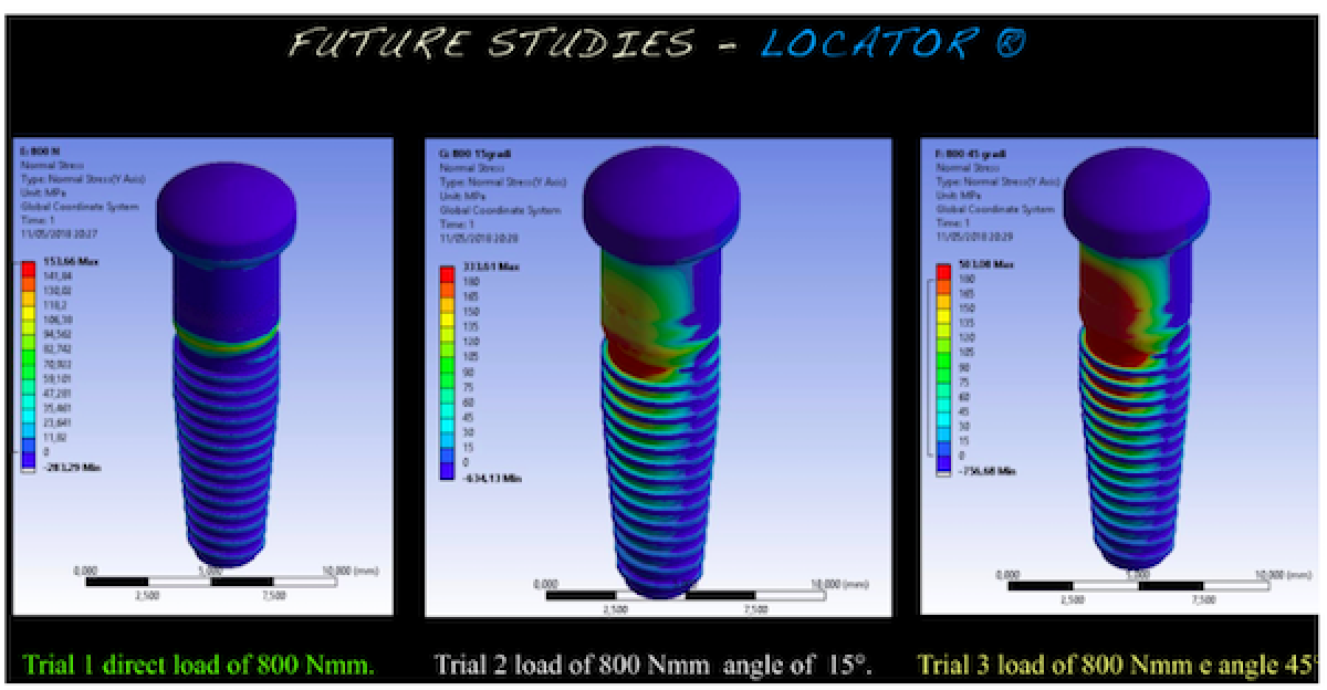 <p>                                    Figure 4:  Locator distribution stress at different direction of loads.            <br></p>