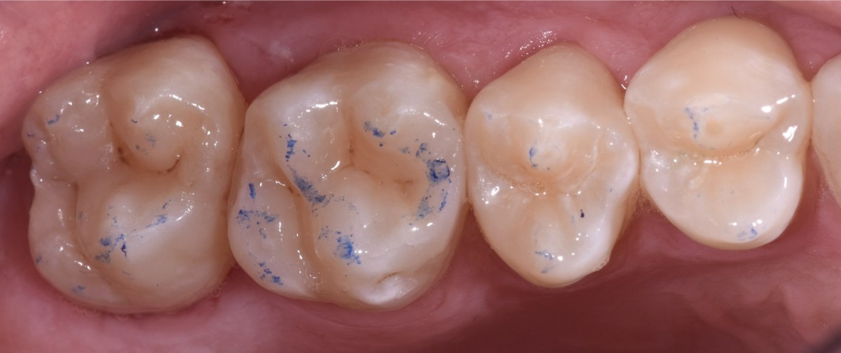 fig8
