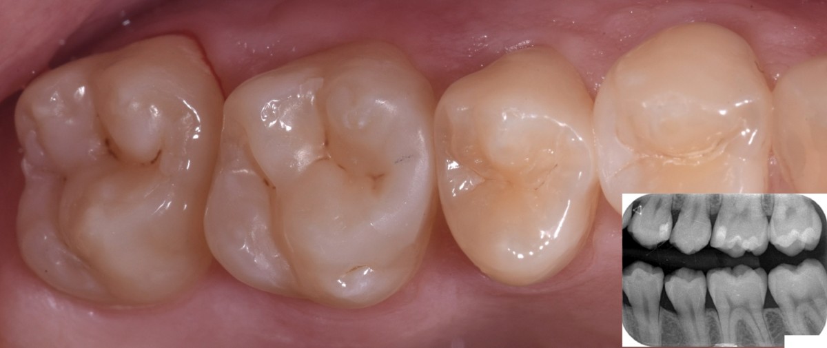 fig9
