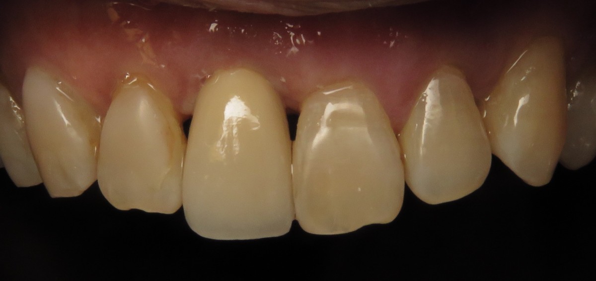 Figure 11
