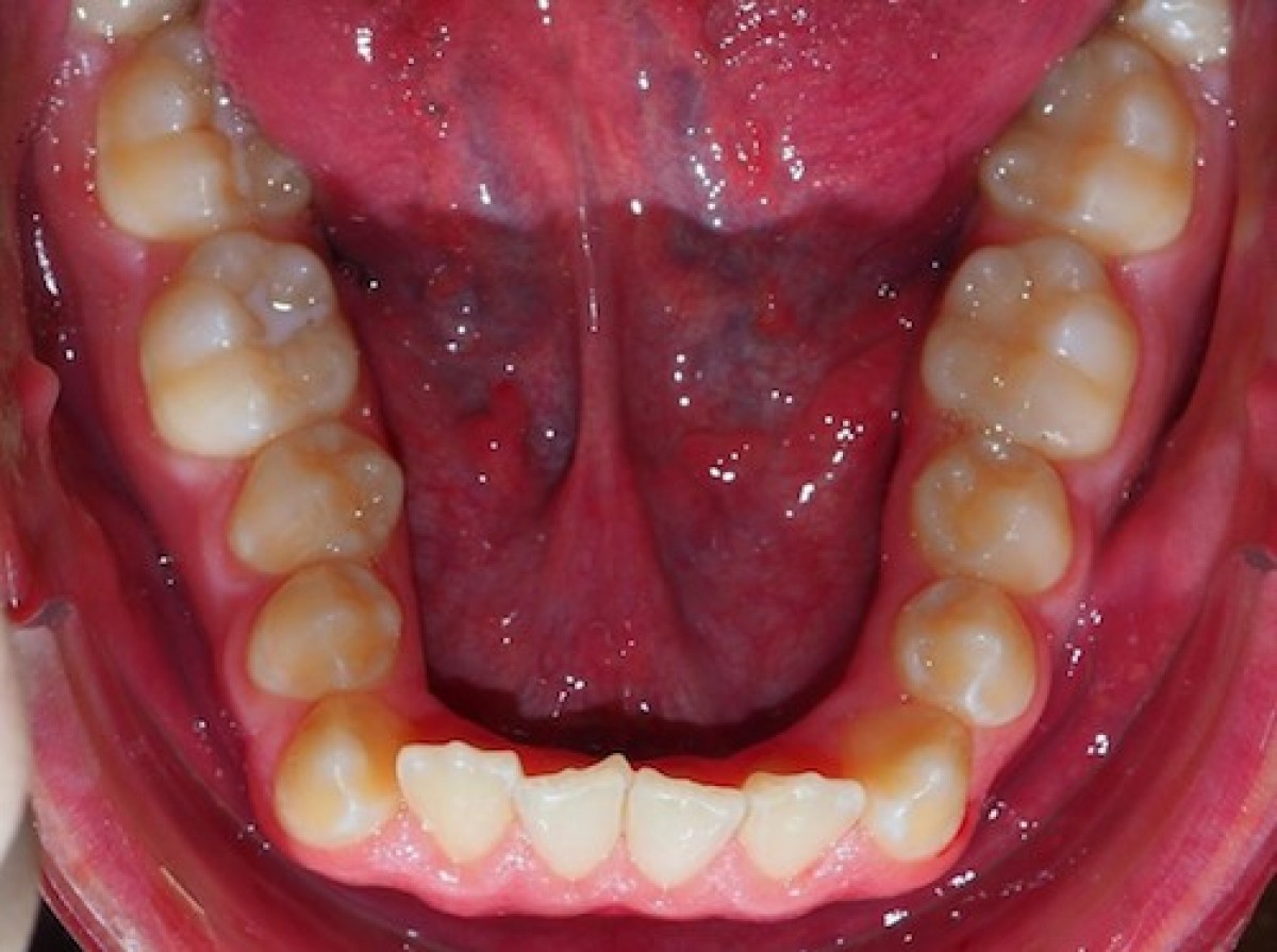 Figure 1: initial archform