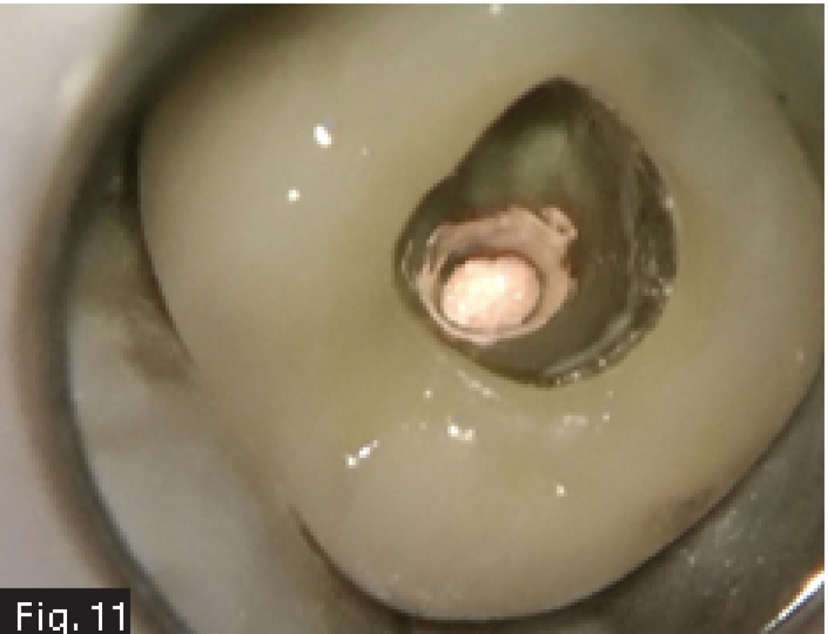 Fig11