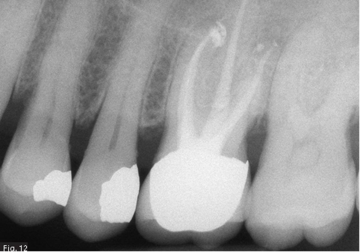 Fig12