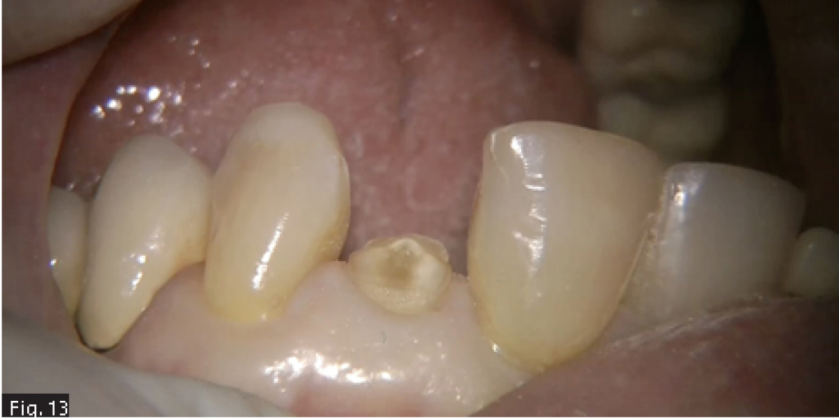 Fig13