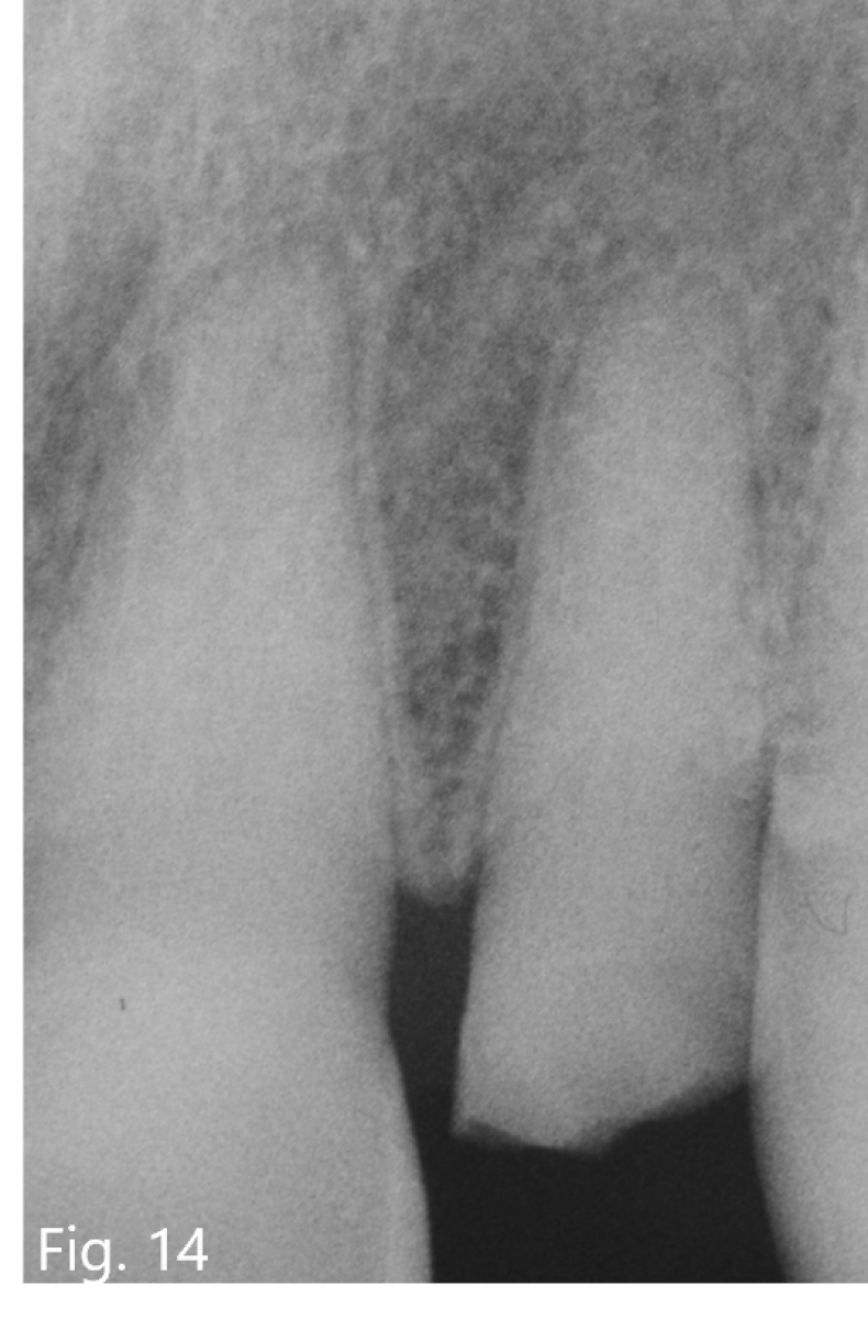 Fig14