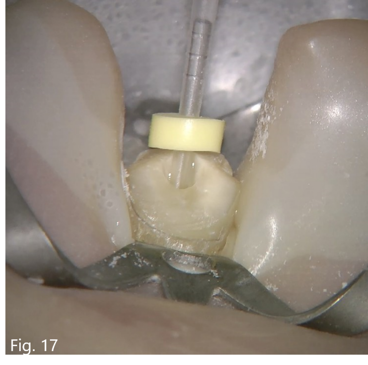 Fig17