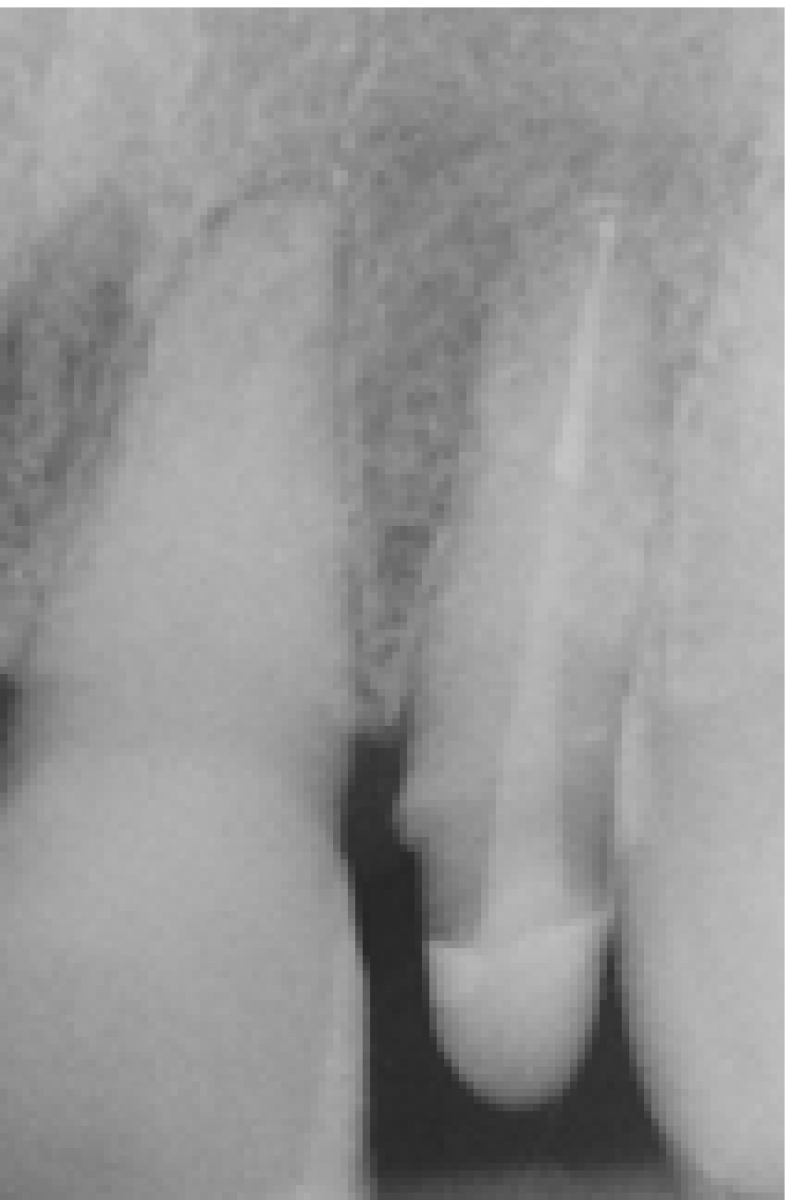 Fig19