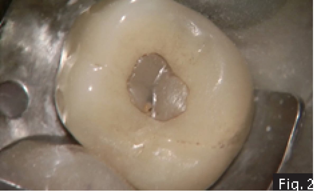 Fig2