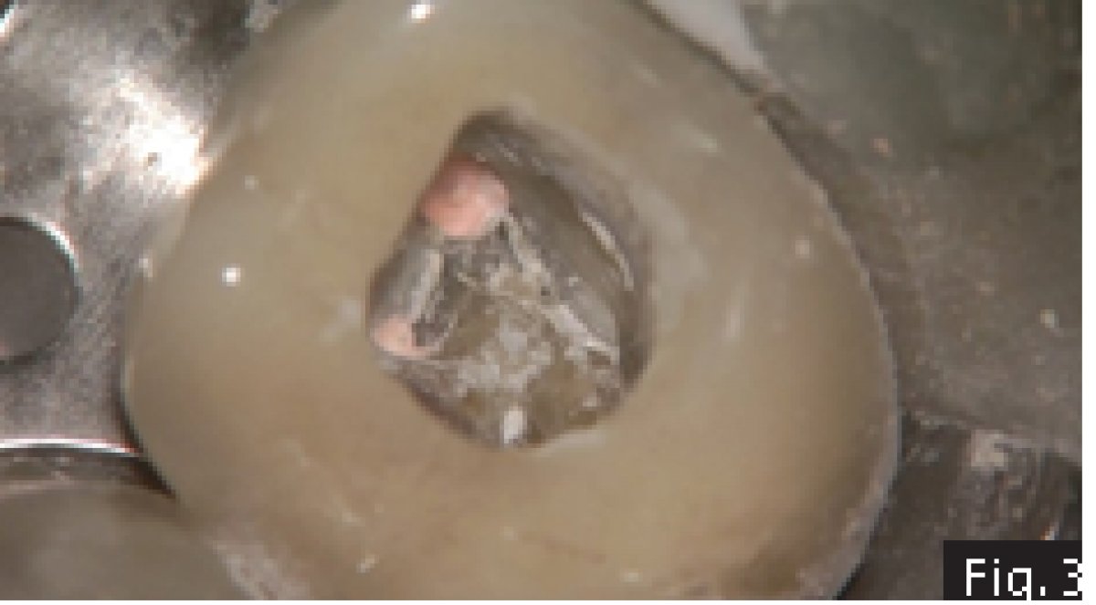 Fig3