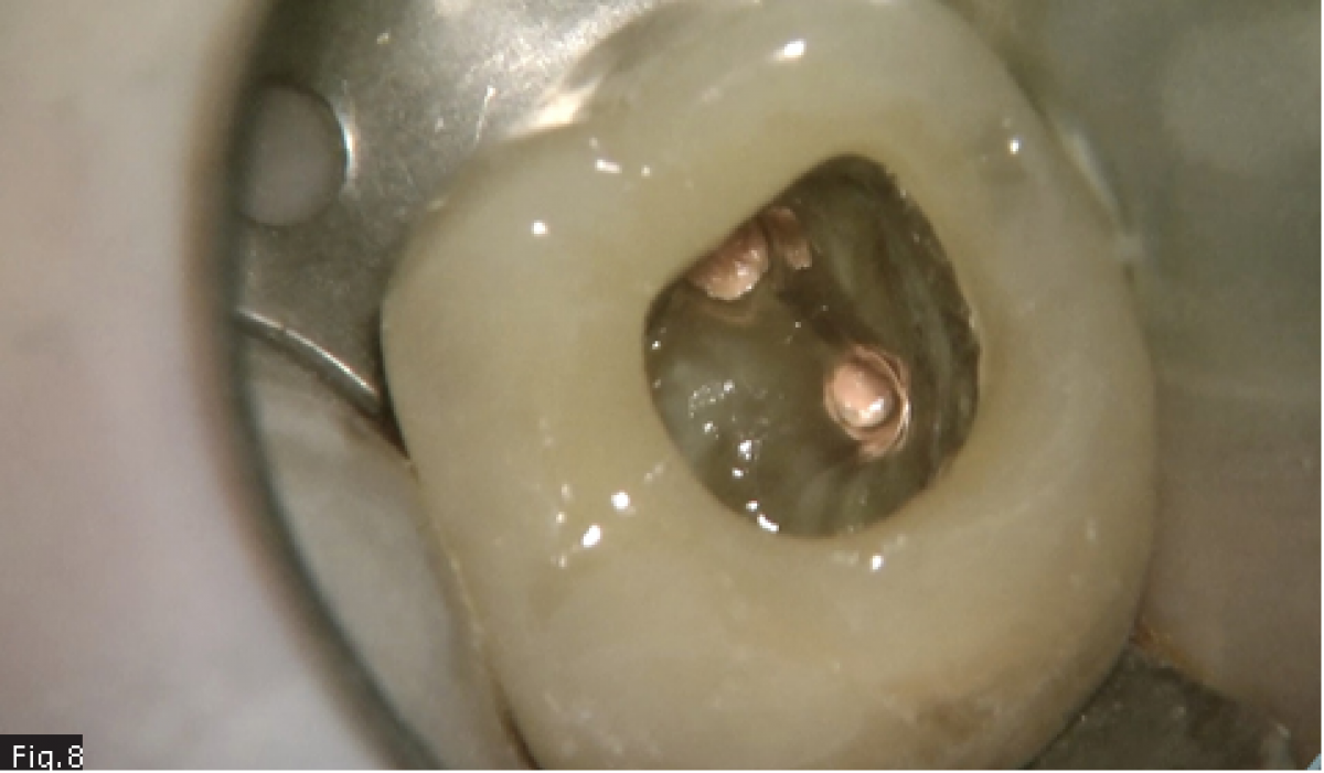 Fig8