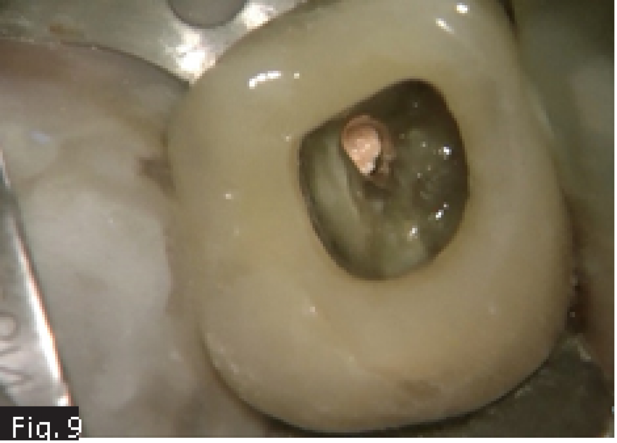 Fig9
