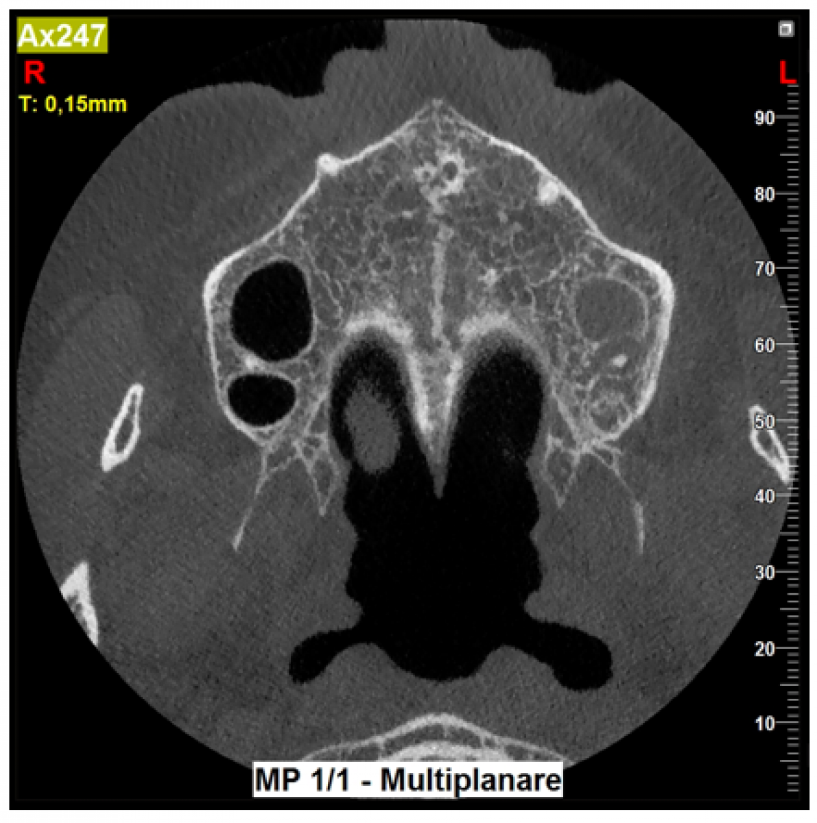 Figure 3 CBCT