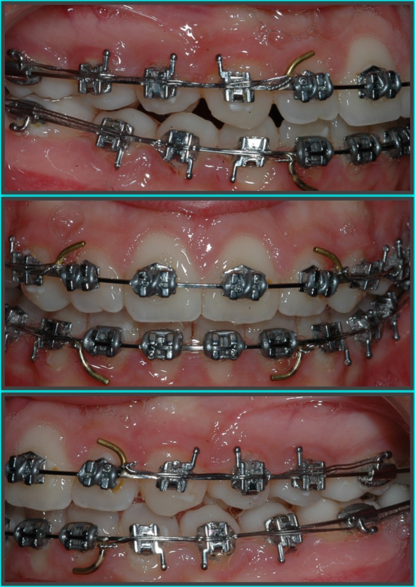 Figure 11