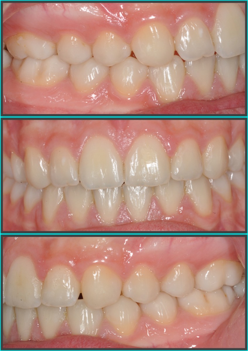 Figure 13