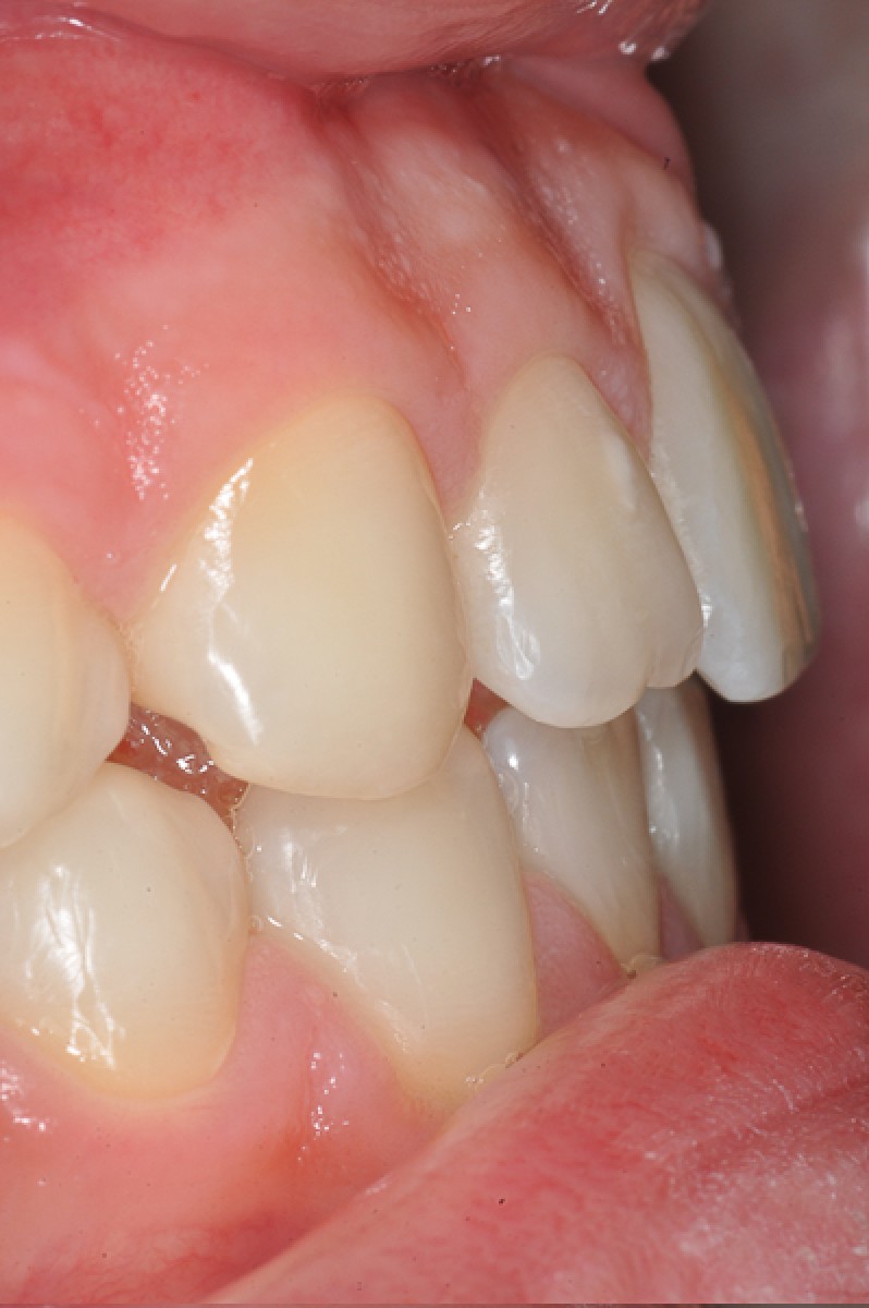 Figure 14
