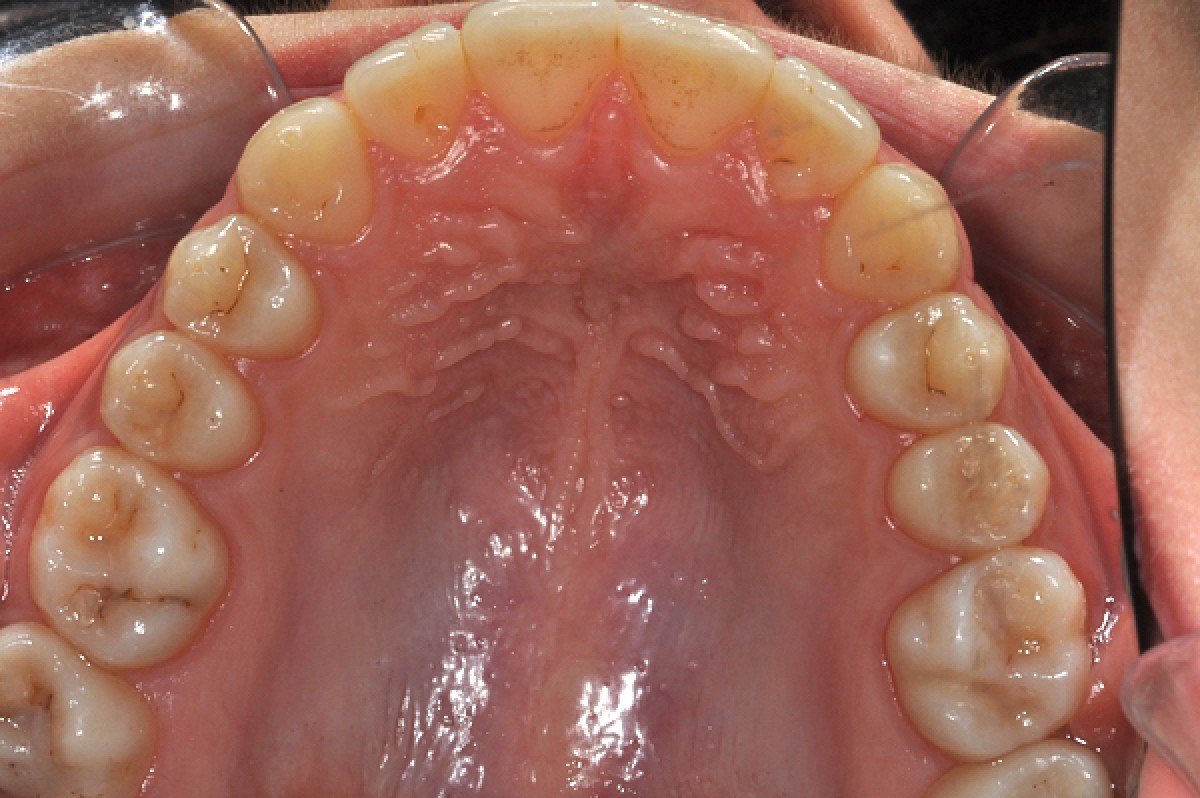 Figure 15