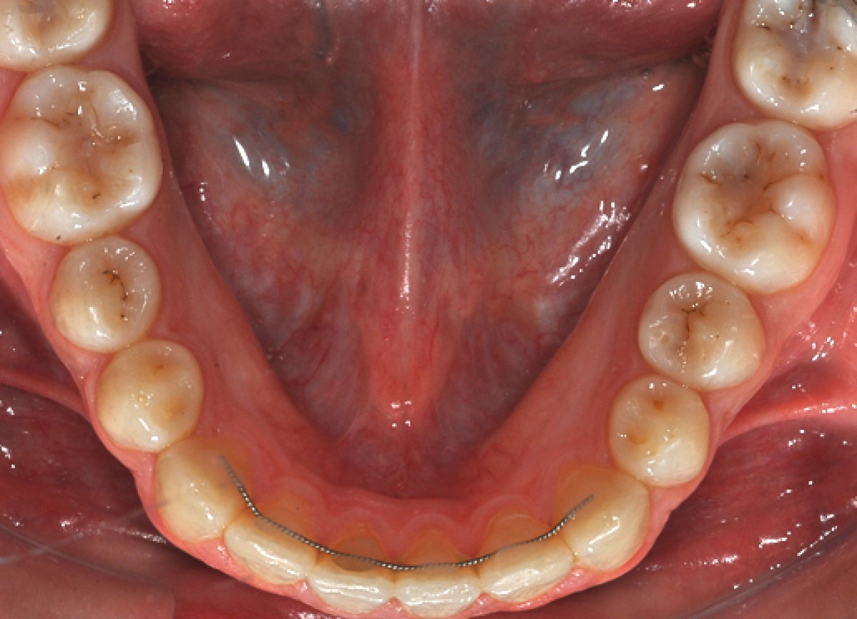 Figure 16