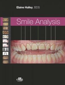 Smile Analysis - Edra Publishing book cover